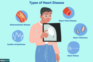 overview of heart disease 4160961 final 152f46073f2242999b771e409973825b